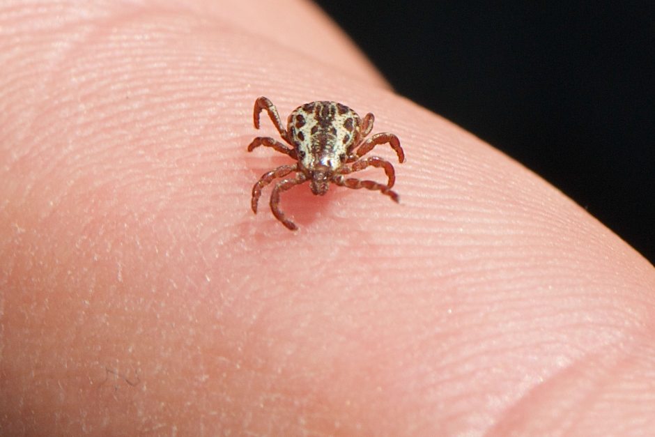 How to Remove the Ticks Stuck Under the Skin 4 Natural