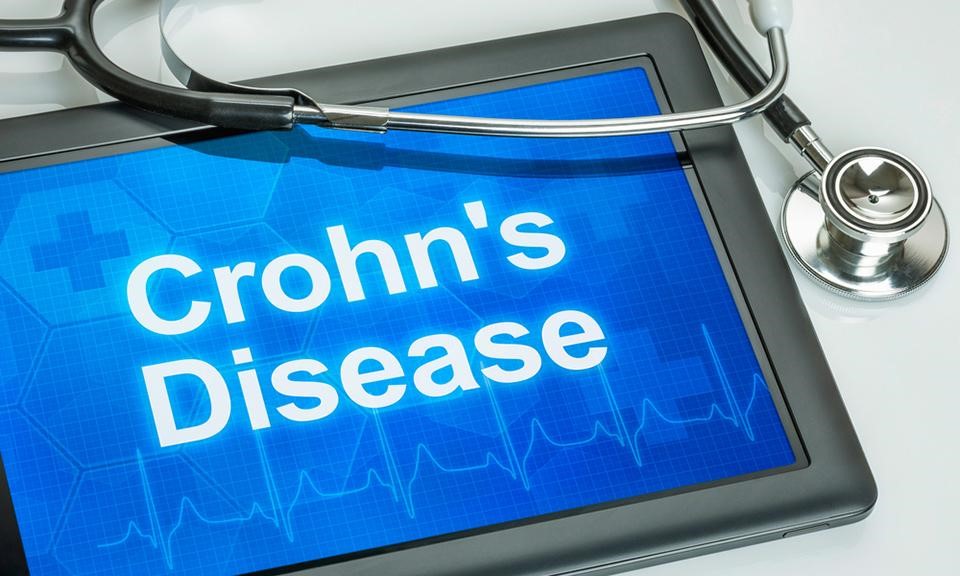 Crohns Disease Symptoms And Treatment Top Natural Reme S
