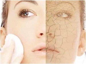 Home Remedies for Dry Skin