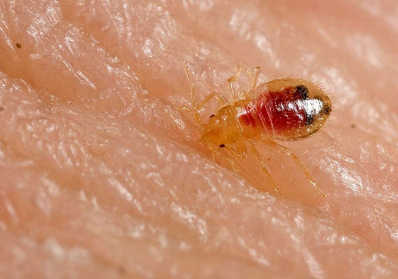 bed bug bites treatment