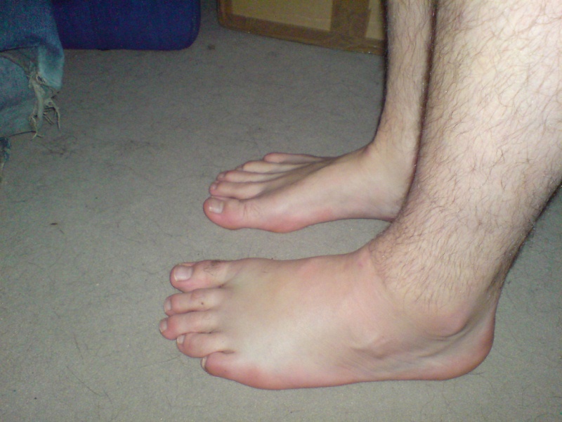 swollen ankles warning sign