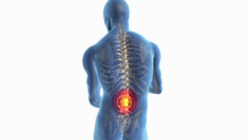 sciatica-and-back-pain